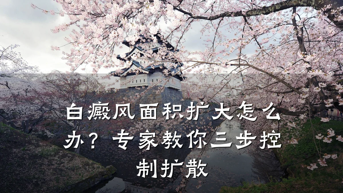 白癜风面积扩大怎么办?专家教你三步控制扩散